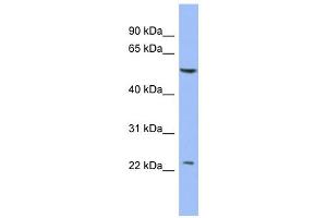 WB Suggested Anti-PABPC1L2A Antibody Titration:  0. (PABPC1L2A Antikörper  (Middle Region))