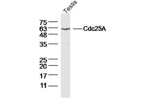 Mouse Testis lysates probed with Cdc25A Polyclonal Antibody, Unconjugated  at 1:300 dilution and 4˚C overnight incubation.