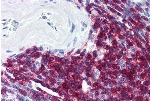 Human Spleen (formalin-fixed, paraffin-embedded) stained with CD5 antibody ABIN298515 at 20 ug/ml followed by biotinylated anti-mouse IgG secondary antibody ABIN481714, alkaline phosphatase-streptavidin and chromogen. (CD5 Antikörper)