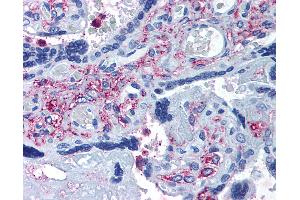 Anti-ADAMTS5 antibody IHC of human placenta. (ADAMTS5 Antikörper  (Internal Region))