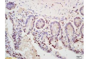 Formalin-fixed and paraffin embedded mouse intestine labeled with Rabbit Anti MSH2 Polyclonal Antibody, Unconjugated (ABIN672816) at 1:200 followed by conjugation to the secondary antibody and DAB staining (MSH2 Antikörper  (AA 101-200))