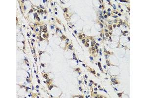 Immunohistochemistry of paraffin-embedded Human colon using CASC5 Polyclonal Antibody at dilution of 1:100 (40x lens). (CASC5 Antikörper)