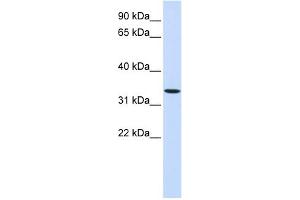 Western Blotting (WB) image for anti-Wingless-Type MMTV Integration Site Family, Member 6 (WNT6) (Middle Region) antibody (ABIN2782719)