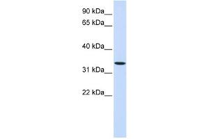 WB Suggested Anti-WNT6 Antibody Titration:  0. (WNT6 Antikörper  (Middle Region))