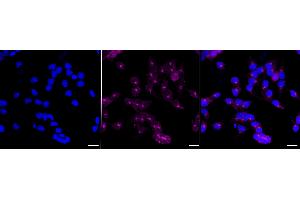 anti-Fibrinogen alpha Chain (FGA) antibody