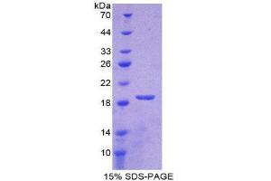 SDS-PAGE (SDS) image for Superoxide Dismutase 1, Soluble (SOD1) (AA 2-153) protein (His tag) (ABIN1080854) (SOD1 Protein (AA 2-153) (His tag))