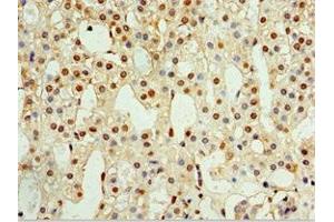 Immunohistochemistry of paraffin-embedded human adrenal gland tissue using ABIN7146290 at dilution of 1:100 (CALCB Antikörper  (AA 1-127))