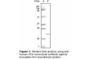 Image no. 2 for anti-Cardiac Troponin I (TNNI3) antibody (ABIN232097) (TNNI3 Antikörper)