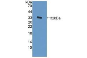 Detection of Recombinant PKR, Human using Polyclonal Antibody to Protein Kinase R (PKR) (EIF2AK2 Antikörper  (AA 224-502))