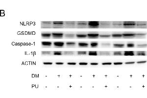 Western Blotting (WB) image for anti-NLR Family, Pyrin Domain Containing 3 (NLRP3) (C-Term) antibody (ABIN6144662)