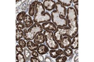Immunohistochemical staining of human kidney with CD34 polyclonal antibody  shows strong cytoplasmic positivity in cells of tubules at 1:50-1:200 dilution. (CDC34 Antikörper)