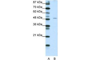 WB Suggested Anti-NFIB Antibody Titration:  1. (NFIB Antikörper  (Middle Region))