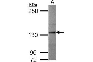 Western Blotting (WB) image for anti-Sema Domain, Seven thrombospondin Repeats (Type 1 and Type 1-Like), Transmembrane Domain (TM) and Short Cytoplasmic Domain, (Semaphorin) 5A (SEMA5A) (AA 700-1000) antibody (ABIN1501911) (SEMA5A Antikörper  (AA 700-1000))