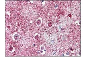 Immunohistochemistry: TAOK1 antibody staining of Formalin-Fixed, Paraffin-Embedded Human Brain, Cortex.