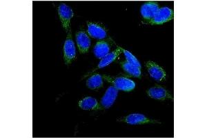 IF analysis of FLCN using anti-FLCN antibody (ABIN7602491).