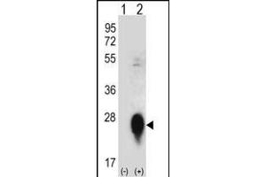 Western blot analysis of CLEC3B (arrow) using rabbit polyclonal CLEC3B Antibody (Center) (ABIN656570 and ABIN2845832). (CLEC3B Antikörper  (AA 95-122))