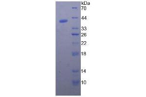 SDS-PAGE analysis of Pig BNP. (Brain Natriuretic Peptide (BNP) Peptid)