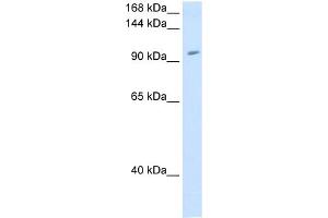 WB Suggested Anti-RNF40 Antibody Titration:  1. (RNF40 Antikörper  (C-Term))