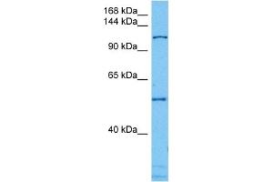 Host:  Mouse  Target Name:  CAND1  Sample Tissue:  Mouse Testis  Antibody Dilution:  1ug/ml (CAND1 Antikörper  (N-Term))