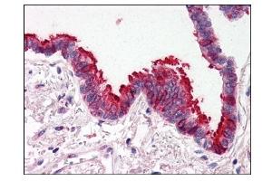 Image no. 1 for anti-SKI-Like Oncogene (SKIL) (N-Term) antibody (ABIN303248) (SKIL Antikörper  (N-Term))