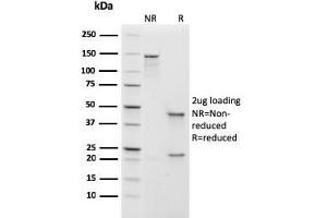 SDS-PAGE Analysis Purified IgM Recombinant Mouse Monoclonal Antibody (rIGHM/1623). (Rekombinanter IGHM Antikörper)