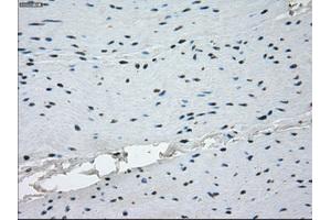 Immunohistochemical staining of paraffin-embedded endometrium tissue using anti-KDM4C mouse monoclonal antibody. (KDM4C Antikörper)
