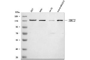 Western blot analysis of SMC2 using anti-SMC2 antibody (ABIN7601453).