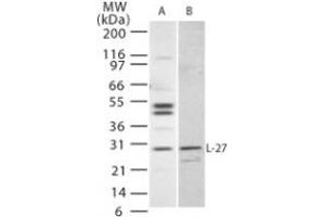 Image no. 1 for anti-Interleukin 27 (IL27) (AA 31-46) antibody (ABIN208552) (IL-27 Antikörper  (AA 31-46))