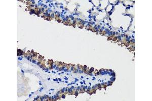 Immunohistochemistry of paraffin-embedded Mouse lung using SCGB1A1 Polyclonal Antibody at dilution of 1:100 (40x lens). (SCGB1A1 Antikörper)