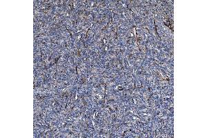 IHC analysis of COL4A3 using anti-COL4A3 antibody (ABIN7600055).