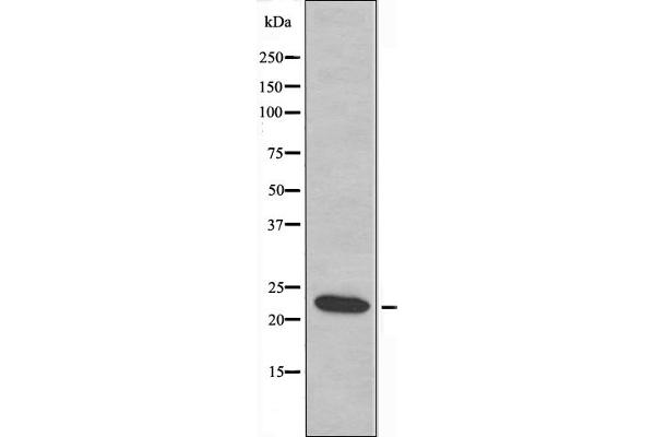 AKAP14 Antikörper  (N-Term)