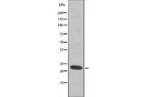 Western blot analysis of extracts from Jurkat cells using AKAP14 antibody. (AKAP14 Antikörper  (N-Term))