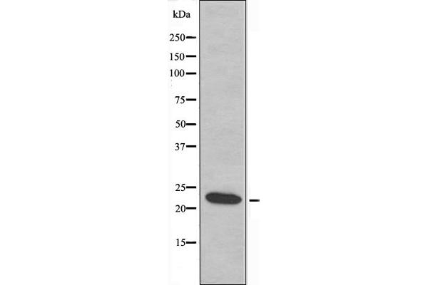 AKAP14 antibody  (N-Term)