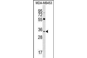 Western blot analysis in MDA-MB453 cell line lysates (35ug/lane). (FKBP6 Antikörper  (C-Term))