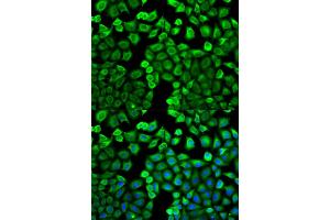 Immunofluorescence analysis of U2OS cells using HNMT antibody (ABIN5971352). (HNMT Antikörper)
