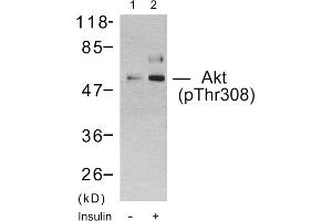 Western blot analysis using Akt (Phospho-Thr308) Antibody. (AKT1 Antikörper  (pThr308))