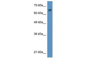 Western Blot showing WT1 antibody used at a concentration of 1-2 ug/ml to detect its target protein. (WT1 Antikörper  (N-Term))