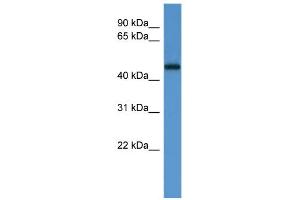 WB Suggested Anti-LCOR Antibody Titration: 0. (Lcor Antikörper  (Middle Region))
