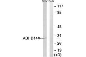 Western Blotting (WB) image for anti-Abhydrolase Domain Containing 14A (ABHD14A) (AA 201-250) antibody (ABIN2890082) (ABHD14A Antikörper  (AA 201-250))