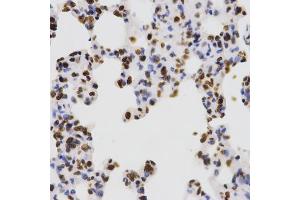 Immunohistochemistry of paraffin-embedded rat lung using Dimethyl-Histone H3-K4 antibody (ABIN5969803) at dilution of 1/200 (40x lens). (Histone 3 Antikörper  (H3K4me2))