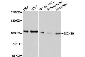 Western blot analysis of extracts of various cell lines, using SOX30 antibody. (SOX30 Antikörper  (AA 604-753))