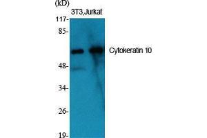 Western Blot (WB) analysis of specific cells using Cytokeratin 10 Polyclonal Antibody. (Keratin 10 Antikörper  (Internal Region))