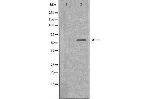 Western blot analysis of extracts from HeLa cells, using Dyskerin antibody. (DKC1 Antikörper  (Internal Region))