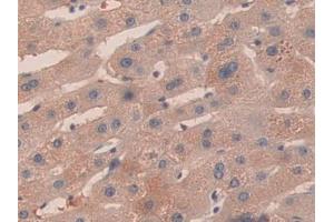 Used in DAB staining on fromalin fixed paraffin- embedded kidney tissue (KIR2DS2 Antikörper  (AA 22-304))