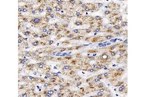 Immunohistochemistry analysis of paraffin-embedded human liver using,AGXT (ABIN7072987) at dilution of 1: 2000 (AGXT Antikörper)