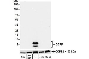 Western Blotting (WB) image for anti-Calcitonin-Related Polypeptide alpha (CALCA) (AA 75-125) antibody (ABIN7452578)