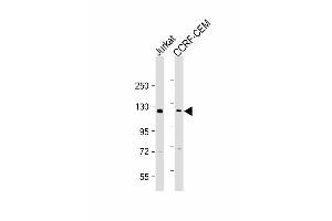 All lanes : Anti-GLI2 Antibody (C-term) at 1:2000 dilution Lane 1: Jurkat whole cell lysate Lane 2: CCRF-CEM whole cell lysate Lysates/proteins at 20 μg per lane. (GLI2 Antikörper  (C-Term))