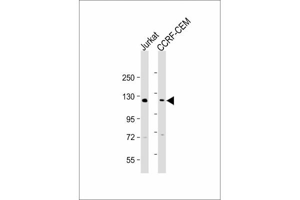GLI2 antibody  (C-Term)