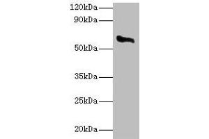 Western blot All lanes: CYP11A1 antibody at 2 μg/mL + Rat adrenal gland tissue Secondary Goat polyclonal to rabbit IgG at 1/10000 dilution Predicted band size: 61, 43 kDa Observed band size: 61 kDa (CYP11A1 Antikörper  (AA 40-521))