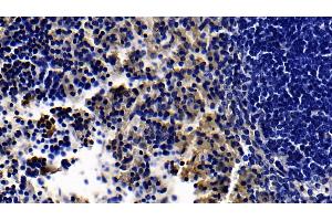 Detection of TLR5 in Mouse Spleen Tissue using Polyclonal Antibody to Toll Like Receptor 5 (TLR5) (TLR5 Antikörper  (AA 693-858))